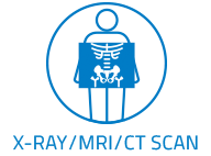 X-Ray/MRI/CT Scan